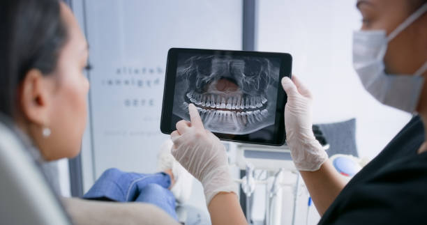 Licensed Teeth Cleaning And Checkup service in Groton, SD - Smile Center Dentistry